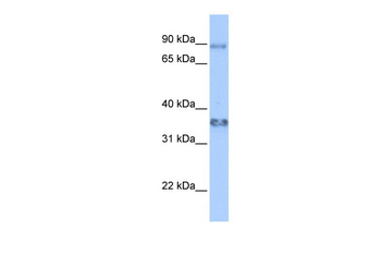ZFP64 Rabbit Polyclonal Antibody