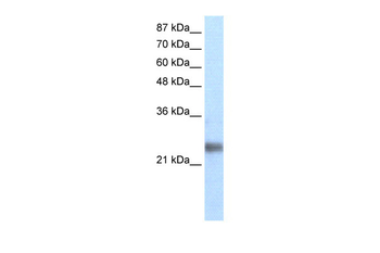 ZNF313 Rabbit Polyclonal Antibody