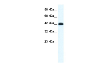 SLC2A4RG Rabbit Polyclonal Antibody