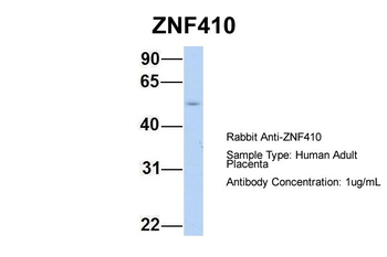 ZNF410 Rabbit Polyclonal Antibody