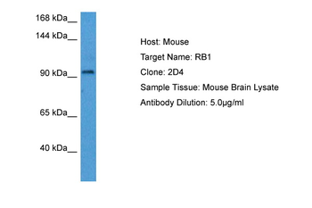 Rb1 Rabbit Polyclonal Antibody