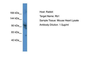 Rb1 Rabbit Polyclonal Antibody