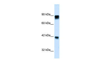 RB1 Rabbit Polyclonal Antibody