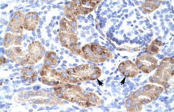 DMRTA2 Rabbit Polyclonal Antibody