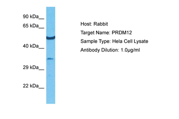 PRDM12 Rabbit Polyclonal Antibody