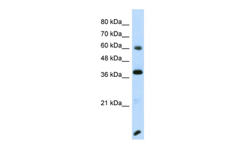 RFX4 Rabbit Polyclonal Antibody