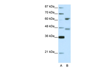 RFX4 Rabbit Polyclonal Antibody