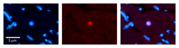 RING1 Rabbit Polyclonal Antibody