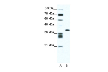 ALX4 Rabbit Polyclonal Antibody