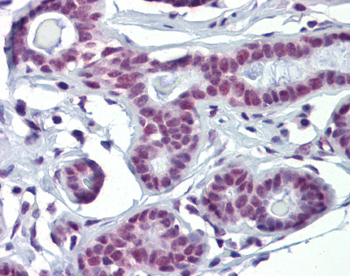 SOX4 Rabbit Polyclonal Antibody