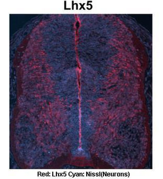 LHX5 Rabbit Polyclonal Antibody