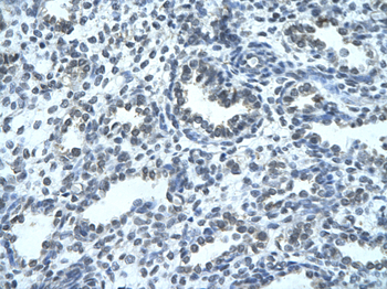 ZNFN1A4 Rabbit Polyclonal Antibody