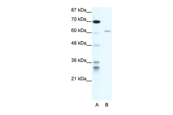ZNFN1A4 Rabbit Polyclonal Antibody