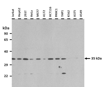 SHOX2 Rabbit Polyclonal Antibody