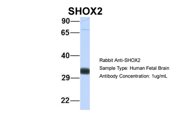 SHOX2 Rabbit Polyclonal Antibody