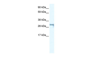 SHOX2 Rabbit Polyclonal Antibody