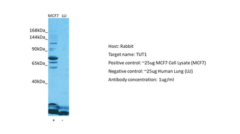 TUT1 Rabbit Polyclonal Antibody