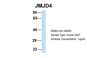 JMJD4 Rabbit Polyclonal Antibody