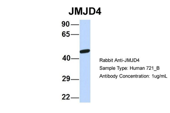 JMJD4 Rabbit Polyclonal Antibody