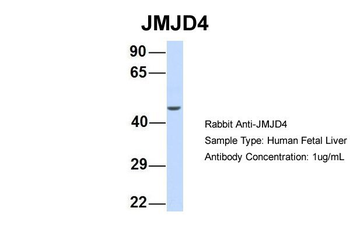 JMJD4 Rabbit Polyclonal Antibody