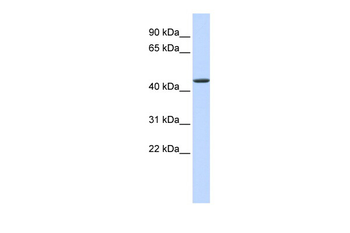 JMJD4 Rabbit Polyclonal Antibody