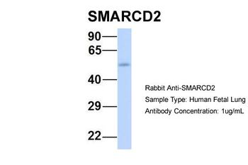 SMARCD2 Rabbit Polyclonal Antibody