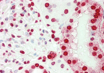 SMARCE1 Rabbit Polyclonal Antibody