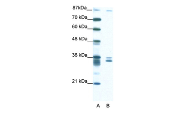 PKNOX2 Rabbit Polyclonal Antibody