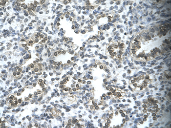 SUPT5H Rabbit Polyclonal Antibody