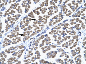 TBX5 Rabbit Polyclonal Antibody