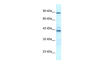 TBX5 Rabbit Polyclonal Antibody