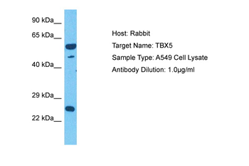 TBX5 Rabbit Polyclonal Antibody