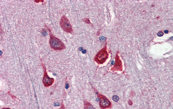 TBX5 Rabbit Polyclonal Antibody