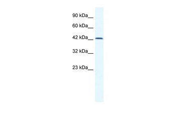 TBX6 Rabbit Polyclonal Antibody