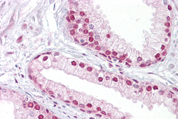 TCEA1 Rabbit Polyclonal Antibody