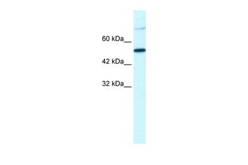 TBX3 Rabbit Polyclonal Antibody