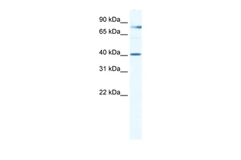 TEAD3 Rabbit Polyclonal Antibody