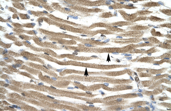 TFAP4 Rabbit Polyclonal Antibody