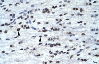 TFAP4 Rabbit Polyclonal Antibody