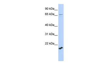 ZFP37 Rabbit Polyclonal Antibody