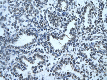 ZFX Rabbit Polyclonal Antibody