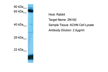 ZNF182 Rabbit Polyclonal Antibody