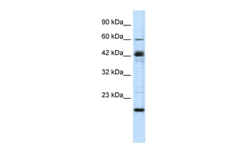 ZNF24 Rabbit Polyclonal Antibody