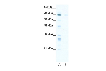ZNF37A Rabbit Polyclonal Antibody