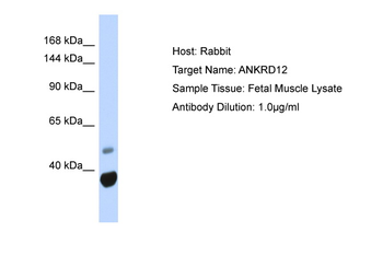 ANKRD12 Rabbit Polyclonal Antibody
