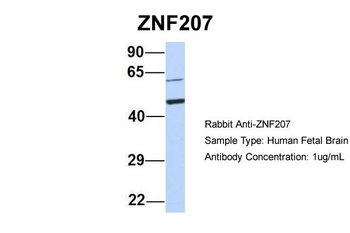 ZNF207 Rabbit Polyclonal Antibody