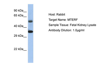 MTERF1 Rabbit Polyclonal Antibody