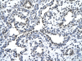 ZNF212 Rabbit Polyclonal Antibody
