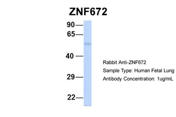 ZNF672 Rabbit Polyclonal Antibody