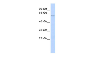 ZNF672 Rabbit Polyclonal Antibody